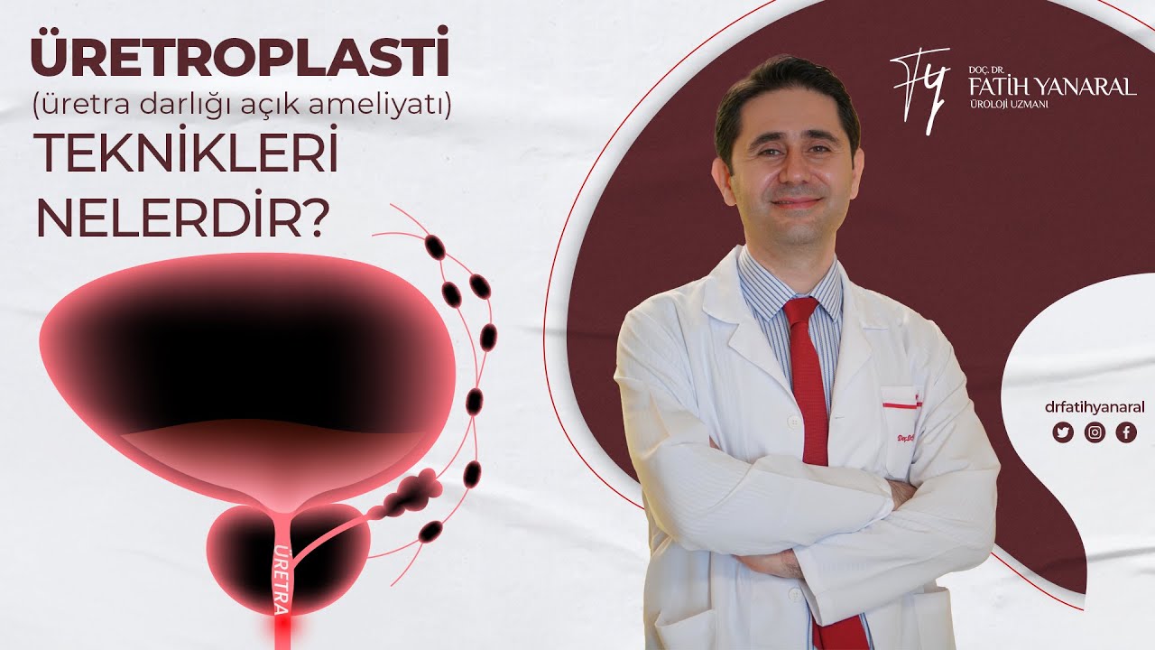 Üretroplasti